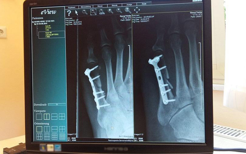 IQGEN’s maiden health-tech fund strikes debut deal