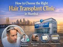 How to Choose the Right Hair Transplant Clinic in Mumbai